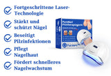 NailCure - Schimmelbehandeling voor Nagels met Laser (50% KORTING)