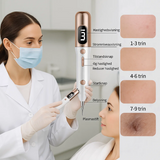 DermaClear | Precieze plasma-pen voor het verwijderen van huidvlekken