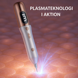 DermaClear | Precieze plasma-pen voor het verwijderen van huidvlekken