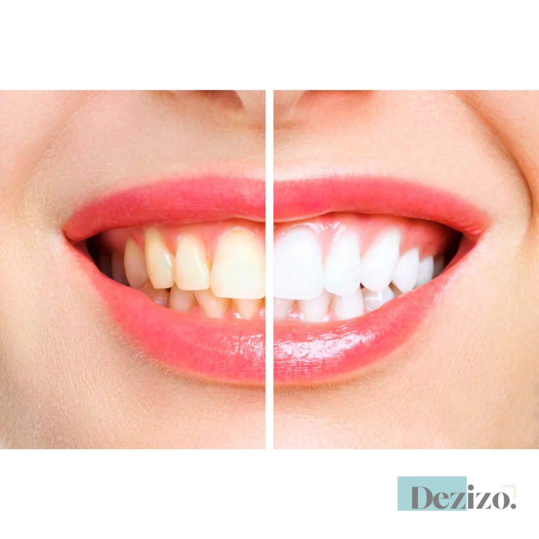 OralTech Pro | Next-gen technologie voor mondverzorging