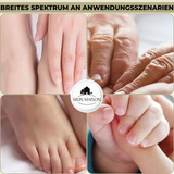 Nagelknipper WideTrim | Extra Brede Snijopening | Anti-Spetter Ontwerp | Roestvrij Staal