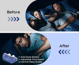 MicroBreath CPAP Lite | Reisvriendelijk Micro CPAP Slaapapparaat – Neusondersteuning Alternatief