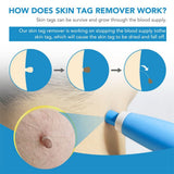 DERMASWIFT – Huidvlekkenverwijderaar tegen Wratten & Huidtags