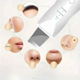 Dermaclean Ultrasonische Huidschraper – Voor Diepe Reiniging en Frisse Poriën