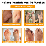Bijengifcrème | Zalf met bijengif, hyaluron & collageen | BeeLixir