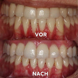 Mineralenpoeder voor Mondverzorging | Versterkt & Beschermt Tanden | SmileSchutz