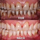 Mineralenpoeder voor Mondverzorging | Versterkt & Beschermt Tanden | SmileSchutz