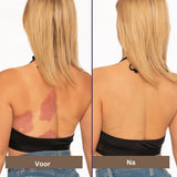 Waterdichte Concealer | Bedekt vlekken, littekens en tatoeages - langdurig