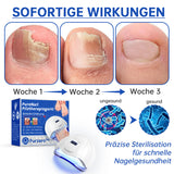 NailCure - Schimmelbehandeling voor Nagels met Laser (50% KORTING)