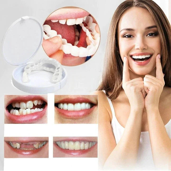 Smile Veneers – Herbruikbare Tanden Facings voor een Stralende Glimlach zonder Tandarts
