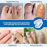 DermaNail - Gepatenteerde nagelschimmeltherapie – voor gezonde nagels binnen 4 weken
