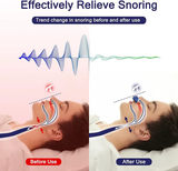 Micro CPAP Slaapapneu Machine voor Reis & Anti-Snurken - CPAP Alternatief