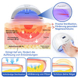 NailCure - Schimmelbehandeling voor Nagels met Laser (50% KORTING)