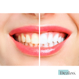 OralTech Pro | Next-gen technologie voor mondverzorging
