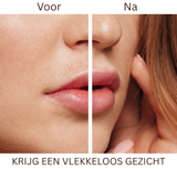 Flawless Gezichtshaarverwijderaar – Ontdek nu een zijdezachte huid!