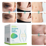 Norvo | Silikon Littekentape Rol