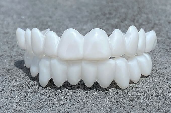SmileFlex – Aanpasbare Tandprothese met Tandheelkundige Lensen
