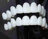 SmileFlex – Aanpasbare Tandprothese met Tandheelkundige Lensen