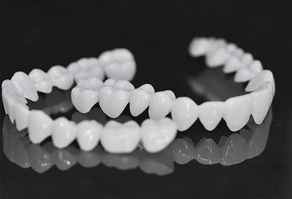 SmileFlex – Aanpasbare Tandprothese met Tandheelkundige Lensen