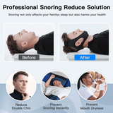 OrthoPlus - Anti-Snurk Kinriem - Effectieve Snurk Oplossing