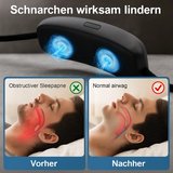 Hypnos | Effectieve Anti-Snurk Stop Apparatuur Kinband