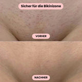 Intimrasierer Vrouwen | Elektrisch Scheerapparaat voor Dames | IntimLisse