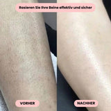 Intimrasierer Vrouwen | Elektrisch Scheerapparaat voor Dames | IntimLisse