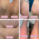 Intimrasierer voor vrouwen | Elektrische damesrasierer voor intiem gebied | Bikini trimmer | Femora