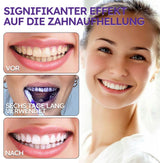 Mineralenpoeder voor Mondverzorging | Versterkt & Beschermt Tanden | SmileSchutz